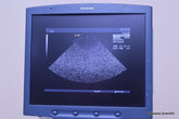 SIEMENS ACUSON SEQUOIA C512 ULTRASOUND MACHINE